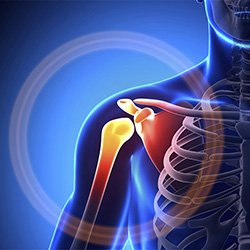 Shoulder Pain and Common Shoulder Problems - Kevin Collins, MD | Sports ...