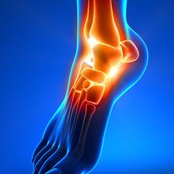Image-of-ankle-pain-Kevin-Collins,-MD-Sports-Medicine---Orthopedic-Surgeon