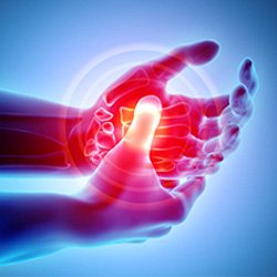 Image of hand Pain Kevin Collins, MD Sports Medicine - Orthopedic Surgeon